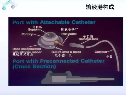 输液港的并发症及护理问题，输液港的并发症及护理