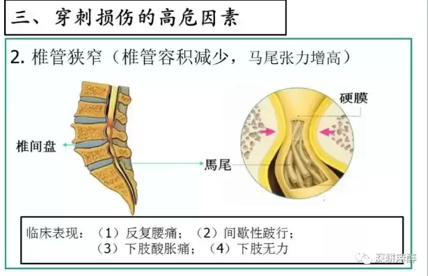 椎管内麻醉的并发症有哪些?如何护理患者，椎管内麻醉的并发症有哪些?如何护理?