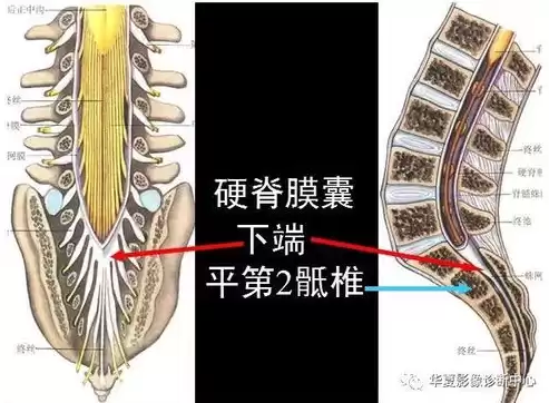 椎管麻醉并发症及处理方法图片，椎管麻醉并发症及处理方法