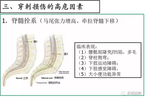 椎管麻醉并发症及处理方法视频，椎管麻醉并发症及处理方法