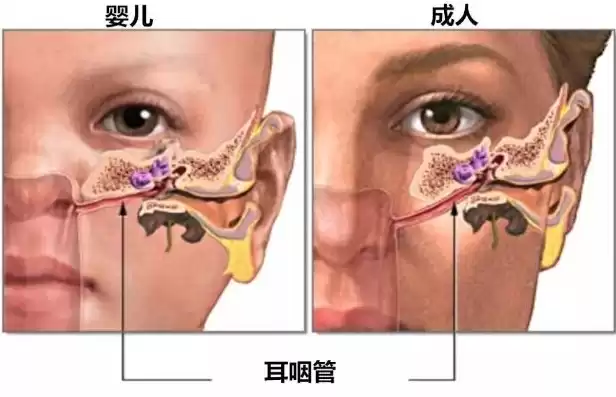 咽鼓管压力测试异常是横杠，咽鼓管压力测试异常