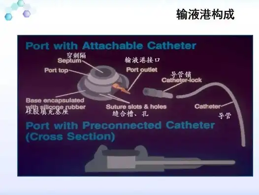 输液港日常维护和并发症护理ppt，输液港植入术后日常护理与并发症预防策略探讨