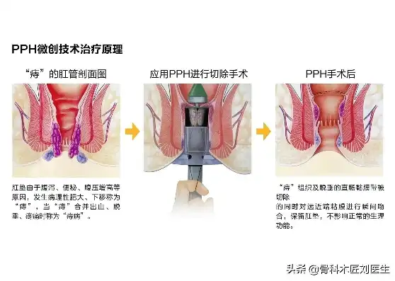 探索混合艺术的魅力，跨界融合的艺术创新之路，混合痔疮怎么治疗最好方法 男性